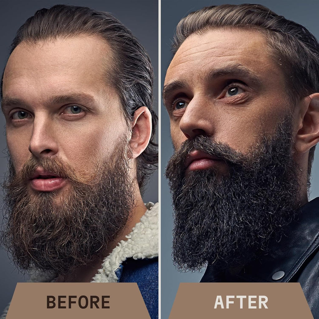 Huile de Croissance de Barbe Pack de 2 - Bois de Santal + Ensemble Derma Roller