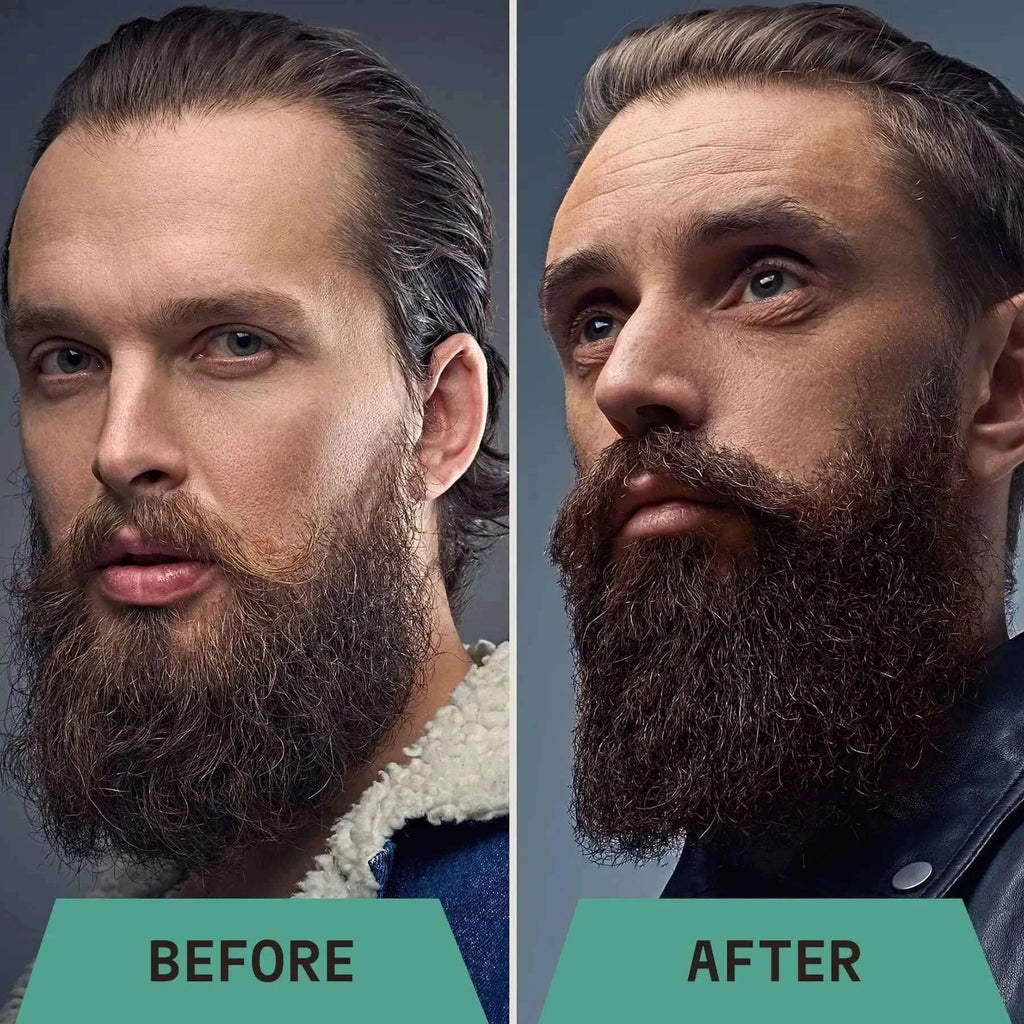 before and after using beard Shampoo 
