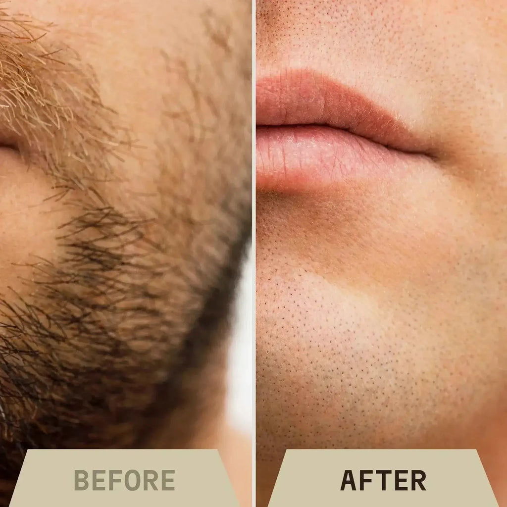 Before and after comparison of beard shaving with men's vanilla shaving cream.